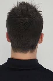 Table of best hair loss vitamins. Best Treatment For Thinning Crown And Receding Hairline Hair Transplant Dubai