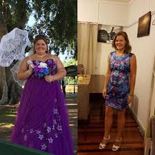 Zoe Lost 45kg In Just Ten Months I Am Lighter Than I Was When I Was In Year 7