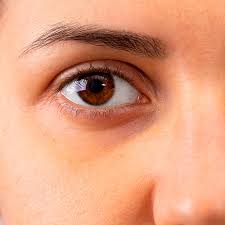 Ojeras Marcadas Tratamientos Esteticos Y Consejos De Maquillaje