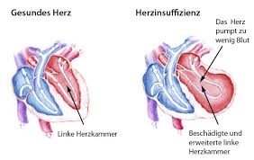Https Herz Charite De Fileadmin User Upload Microsites M Cc11 Herz Zeitung Herzblatt Herz Blatt 02 15 Pdf