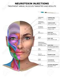 Maybe you would like to learn more about one of these? Neurotoxin Injections Treatment Areas Muscles Targeted And Results Muscles Structure Of The Female Face And Neck Each Muscle With Name On It Royalty Free Cliparts Vectors And Stock Illustration Image 139345239