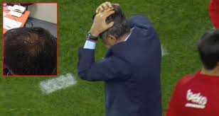 Şenol güneş'in kafası yarıldı mı? Fenerbahce Macinda Cikan Olaylarda Yaralanan Senol Gunes In Kafasina Dikis Atildi Dailymotion Video