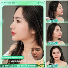 NÂNG MŨI CẤU TRÚC PHONG THỦY KHÁC GÌ VỚI NÂNG MŨI THÔNG THƯỜNG