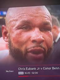 Conor Benn's immediate reaction after losing to Chris Eubank Jr ‼️