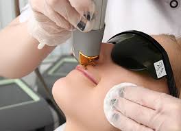 Thanks to its loyal clientele and talented staff, in just 3. Upper Lip Laser Hair Removal In Hyderabad Contours