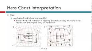 57 true to life diplopia chart