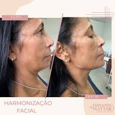 𝙁𝙚𝙧𝙣𝙖𝙣𝙙𝙖 𝙈𝙖𝙩𝙩𝙖𝙧 𝘿𝙚 𝙇𝙖́ 𝙎𝙖́𝙫𝙞𝙖  (@dra.fernandamattardelasavia) • Instagram photos and videos