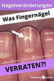 home fingernagel nagel nagellack ideen
