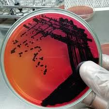 Uses of salmonella shigella agar Salmonella On Xld Agar Mikrobiyoloji Microbiology Microbiologia Microscope Laboratuvar Laboratory Laboratorio Labora Microbiology Salmonella Agar
