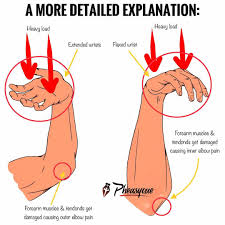 Common causes of elbow pain include: Pheasyque Com What Causes Outer Or Inner Elbow Pain Facebook