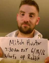 Disfigured ex-soldier shares details about his life-changing face  transplant