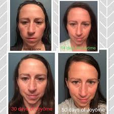 Unexpected skincare discovery for puffy face and redness