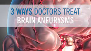 3 Ways Doctors Can Treat Your Brain Aneurysm - Youtube
