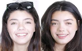 Patient Before & Afters