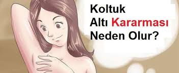koltuk alti kararmasinin 6 nedeni kadinlar kulubu