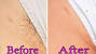 1 4 Inch Brazilian Wax Hair Length