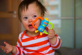 Guest Opinion Abortion Of Children With Down Syndrome Hints At Eugenics Deseret News