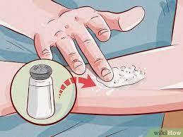 How to remove tattoo naturally at home without laser. 3 Ways To Remove A Tattoo Wikihow Life