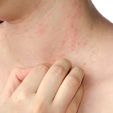 We did not find results for: 10 Things You Should Know About Cutaneous Cell Lymphoma City Of Hope Breakthroughs
