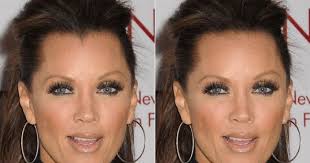 Laser Removal Widows Peak Tattoo Removal Voucher