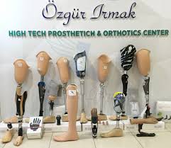 Bacak Protezi Ozgur Irmak Protez Ve Ortez Merkezi