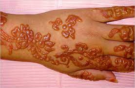 It can cause some side effects such as inflammation of the skin (dermatitis) including redness, itching, burning, swelling, scaling, broken skin, blisters, and scarring of the skin. Black Henna I Need Henna Art Company