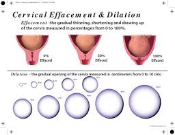 Cervix Dilation Diagram Cervix Dilation Chart Actual Size