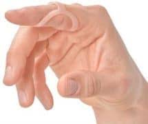 Why You Should See A Doctor For Your Jammed Finger Boutonniere Deformity Oh My Arthritis