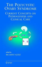 Pcos is characterized by hyperandrogenism, irregular ovulatory cycles. The Polycystic Ovary Syndrome Von Ricardo Azziz Ed Fachbuch Bucher De