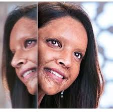 Here Is The 1st Look Of Deepikapadukone Upcomingmovie Chhapaak This Movie Is Based On Laksh Deepika Padukone Upcoming Films Full Movies Download