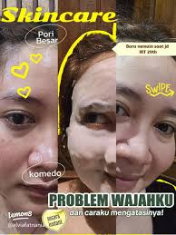 Rekomendasi Clay Mask untuk Mengatasi Komedo dan Jerawat