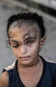 A top Hamas official has praised Anthony Albanese's move to recognise  Palestinian statehood, contradicting the Government's claim that Hamas  would be 'totally opposed' to the move.