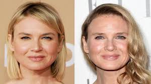 Miranda kerr swears by noni juice; Renee Zellweger Just Isn T Herself Miami Herald