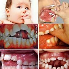 Pin By Veronica Carranza On That S Funny Dental Health Care Dental Health Dental Kids