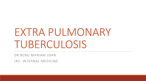Image result for Extrapulmonary Tuberculosis