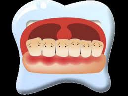 O perioada de timp formata din 10 ani secol (veac): Despre BÄƒieÅ£elul Care Nu Vrea SÄƒ Se Spele Pe DinÅ£i Wmv Youtube