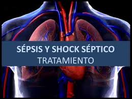 Check spelling or type a new query. Sepsis Y Shock Septico Tratamiento Youtube