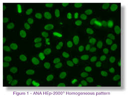 Image result for ANA Staining Pattern