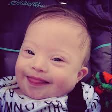 Welcome to my page! My name is Jason Parker Winslow Born in the Seychelles  🇸🇨 I have a spontaneous mutation, deletion of Exons 48-52 September I  will be turning 19 I would