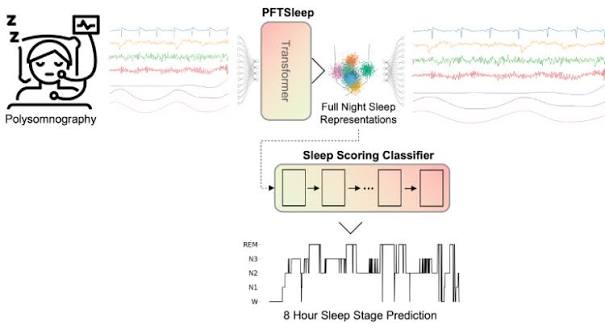 New AI Model Analyzes Full Night of Sleep With High Accuracy in Largest Study of Its Kind | Mount Sinai - New York
