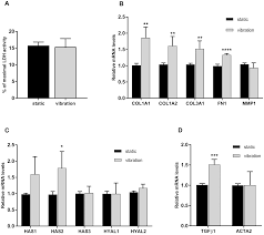 If you wish to get some details; Development And Validation Of A Novel Phonomimetic Bioreactor