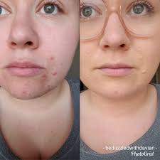 Bedazzled with Davian