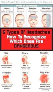no spoilers types of headache : 86 Types Of Headaches Ideas Headache Types Headache Migraine