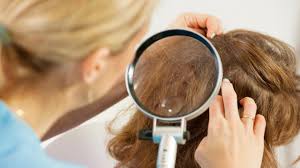 Wann kommen nissen/läuse weg,nach dem 1. Lause So Bekampfen Sie Kopflause Ratgeber Bild De