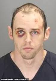 Michigan man suspected of strangling his father to death is seen bloodied  and bruised in mugshot