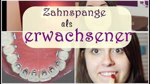 Feste zahnspange von innen kosten. Zahnspange Bei Erwachsenen Lingualtechnik Kosten Jumarie Youtube