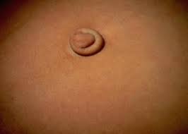 Image result for Umbilicus botryoides
