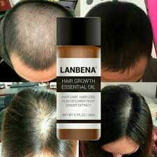 It is a calming oil and known to reduce inflammation. Buy Hair Growth Essentials Products Online In Taiwan At Best Prices