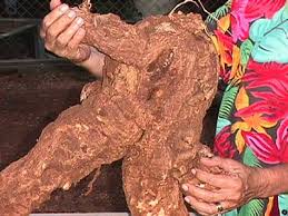 Image result for Erythrina zeyheri