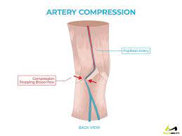Pain Behind Knee Why It Hurts In Back Of Or Under Your Kneecap